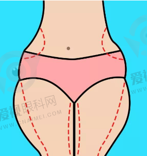fd6b6c85c19a8e600ed1cf6ee3d50df3.png