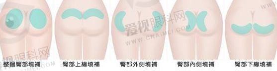 4d85b0924bac7b3521c11f2f6786bf11_570.jpg