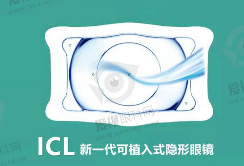 南京东南眼科医院黄蓓医生近视手术口碑不错