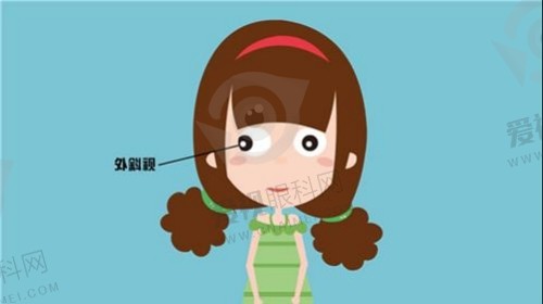 甘肃爱尔眼视光医院擅长项目