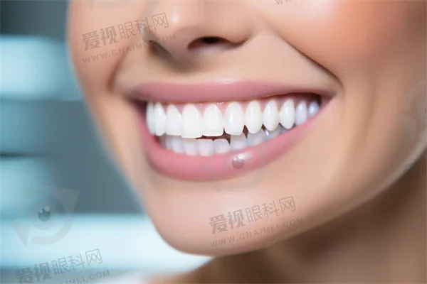 优惠活动