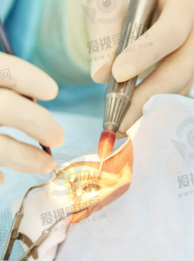 贺州治疗义眼选择哪家医院靠谱？这五家眼科医院实力拔尖技术超赞