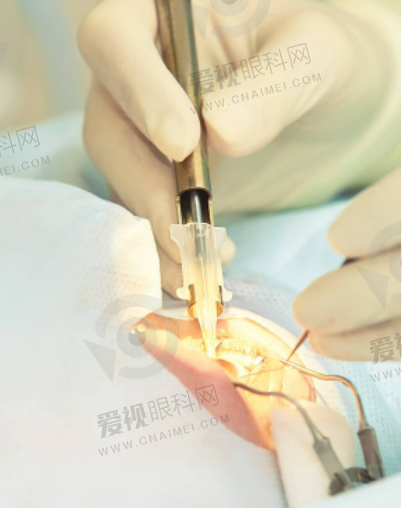 贵港矫正眼选择哪家医院靠谱？这些医院口碑非常好、价格实惠值得推荐