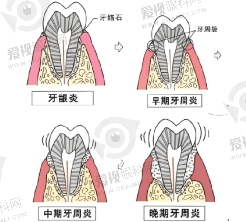 预约攻略与避坑指南