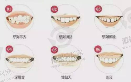 总结