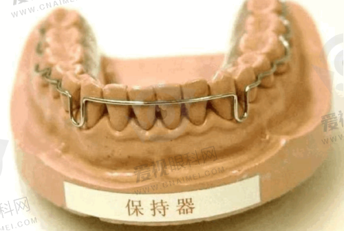 不同项目的选择建议
