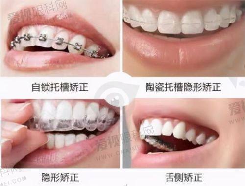 梅州市比较好的口腔诊所详细介绍