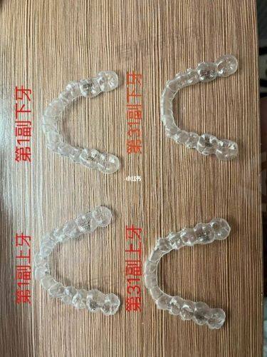 总结