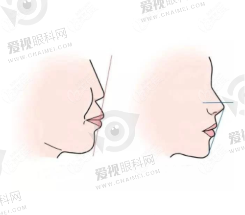 土豆口腔