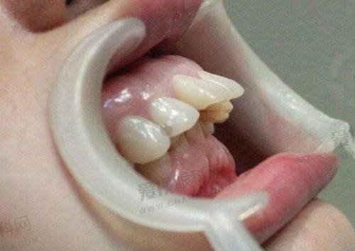 佳美口腔价格与实例分享