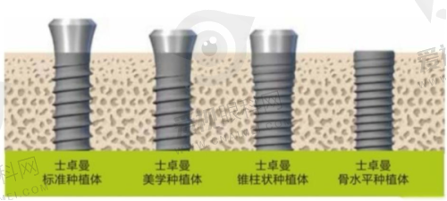 兴城米奇口腔患者口碑与服务亮点