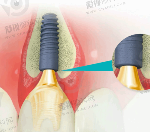 平凉牙齿矫正推荐医院