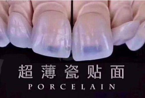 长春正德口腔