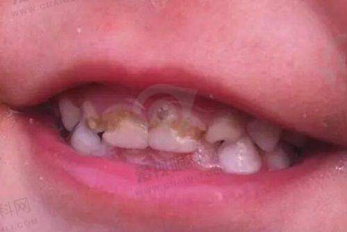 雅致口腔价格优势
