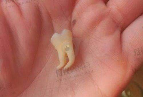 荆州咿呀口腔价格测评