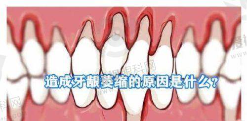 镶牙价格