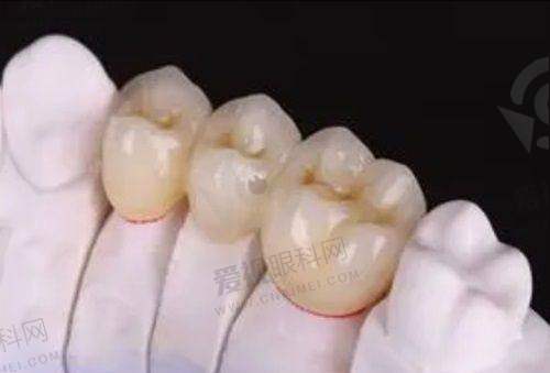 正畸优势及价格