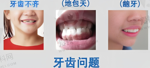 总结
