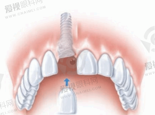 巴中华医口腔