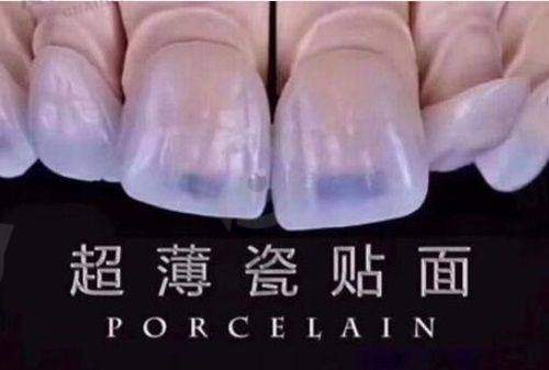 泉州安格尔口腔电话地址