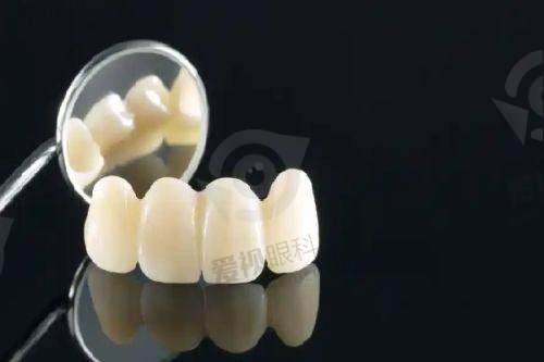 洗牙/补牙/全瓷牙价格