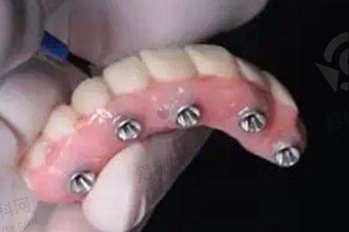 患者实例分享
