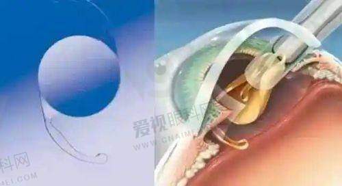 患者体验分享