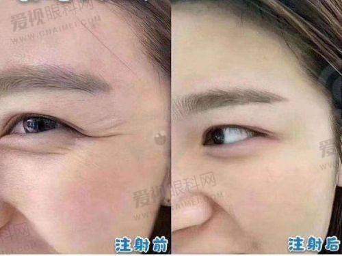 患者评价反馈