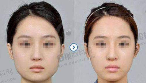 六盘水友好妇产整形美容科2025年价格表