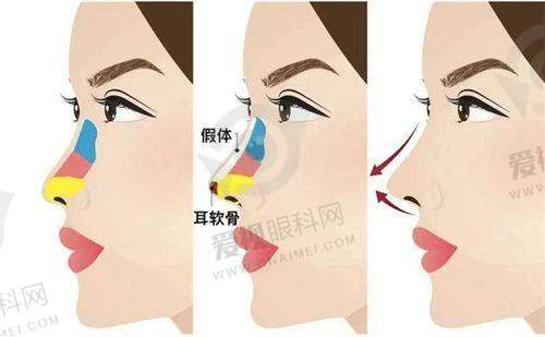 服务理念