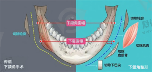 与其他医院对比