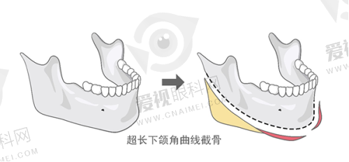 领跑的医疗仪器