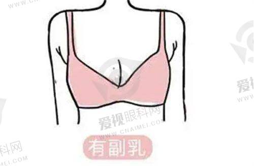 疤痕治疗能力