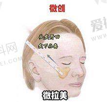 与其他医院对比情况