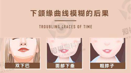 预约挂号攻略