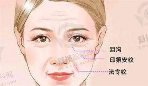 患者选择建议