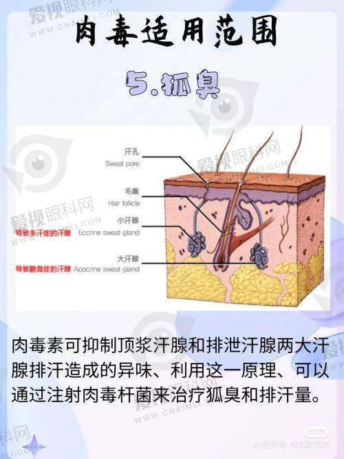 自研技术