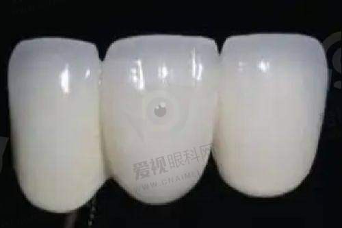 实例分享