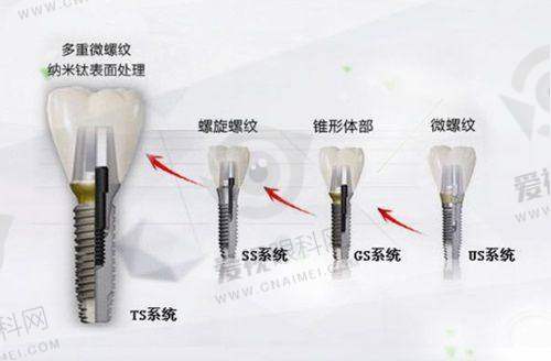 衡水口腔医院预约挂号方式