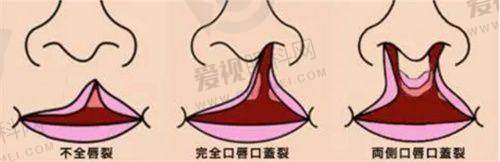 大连悦己时光医疗美容门诊部：玻尿酸丰唇等多项医美项目价格透明，变美超实在