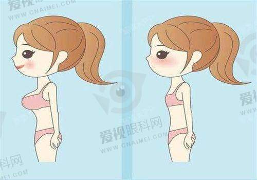 热门整形项目