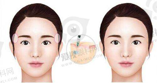 热门医美项目及价格