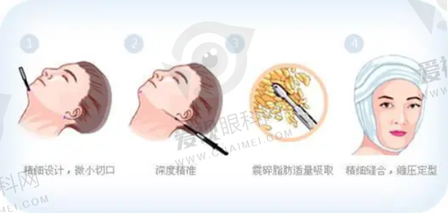 价格透明