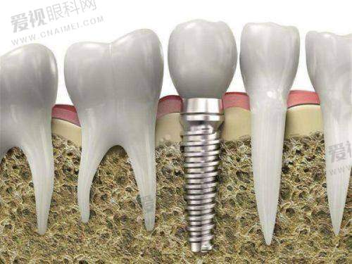 绍兴皓博士口腔时代天使隐形矫正价格分析