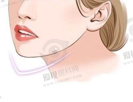 成都做嘴唇一般多少钱？预算1.5w元起解锁自然M唇+人中缩短套餐，附多地唇部整形医院排名 
