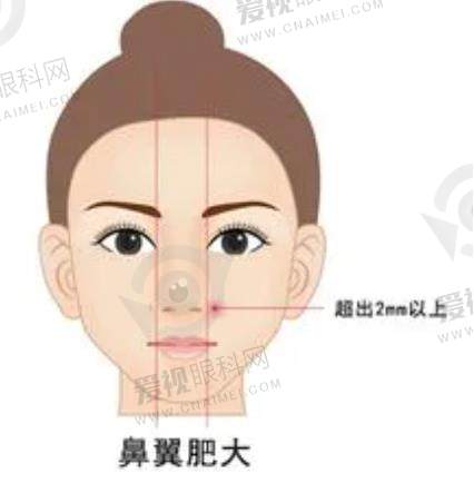 南昌爱思特美容医院鼻整形2025年度收费标准一览：隆鼻手术1.5W/鼻翼缩小手术1.2W/鼻修复手术2W